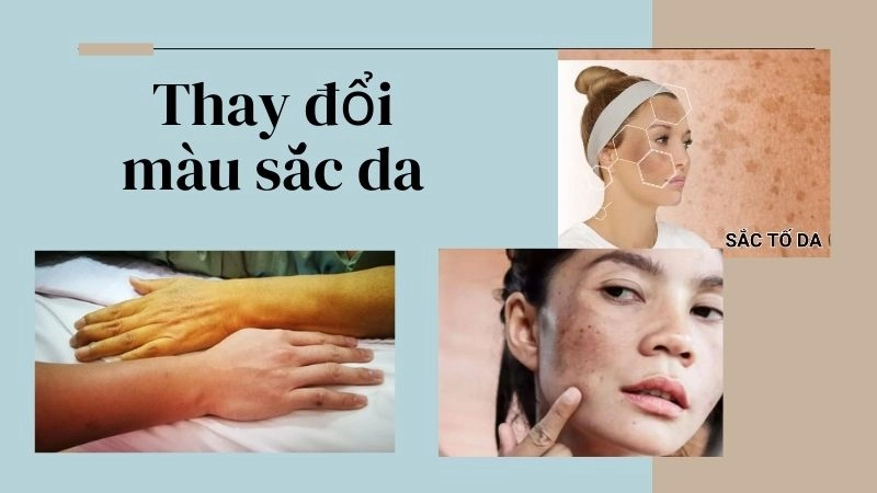 Thay đổi màu sắc da – từ xanh lè đến cam rực