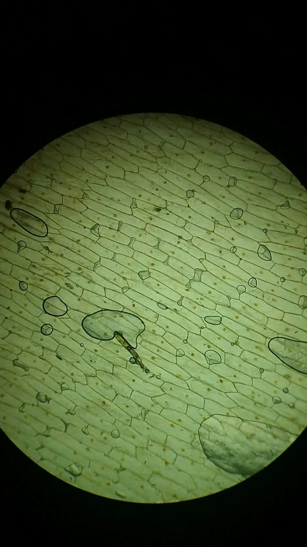 Nhân tế bào thực vật dưới kính hiển vi được nhuộm màu xanh methylen