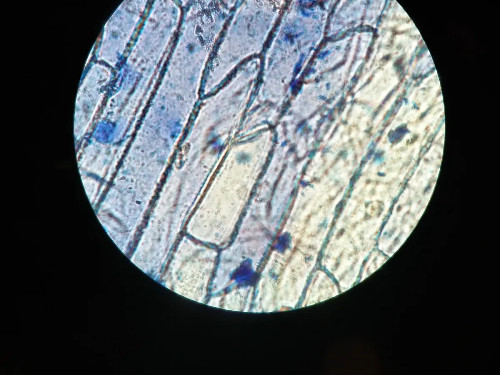 Thành tế bào thực vật dưới kính hiển vi bao quanh chất tế bào