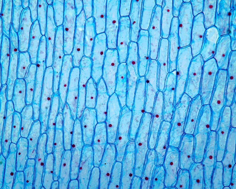 Cấu tạo tế bào thực vật dưới kính hiển vi với các không bào lớn