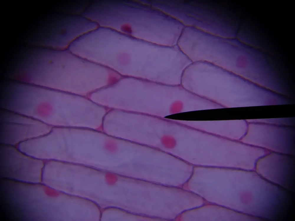 Phân chia tế bào thực vật dưới kính hiển vi ở giai đoạn kỳ giữa