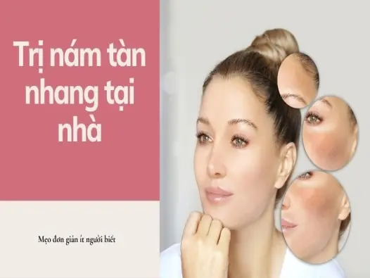 Trị nám tàn nhang tại nhà với mẹo đơn giản ít người biết