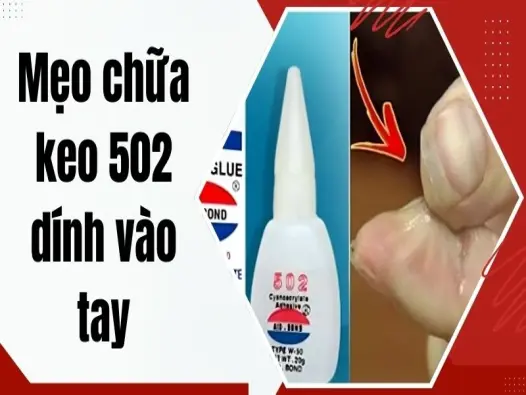 Bật mí mẹo chữa keo 502 dính vào tay cực đỉnh tại nhà