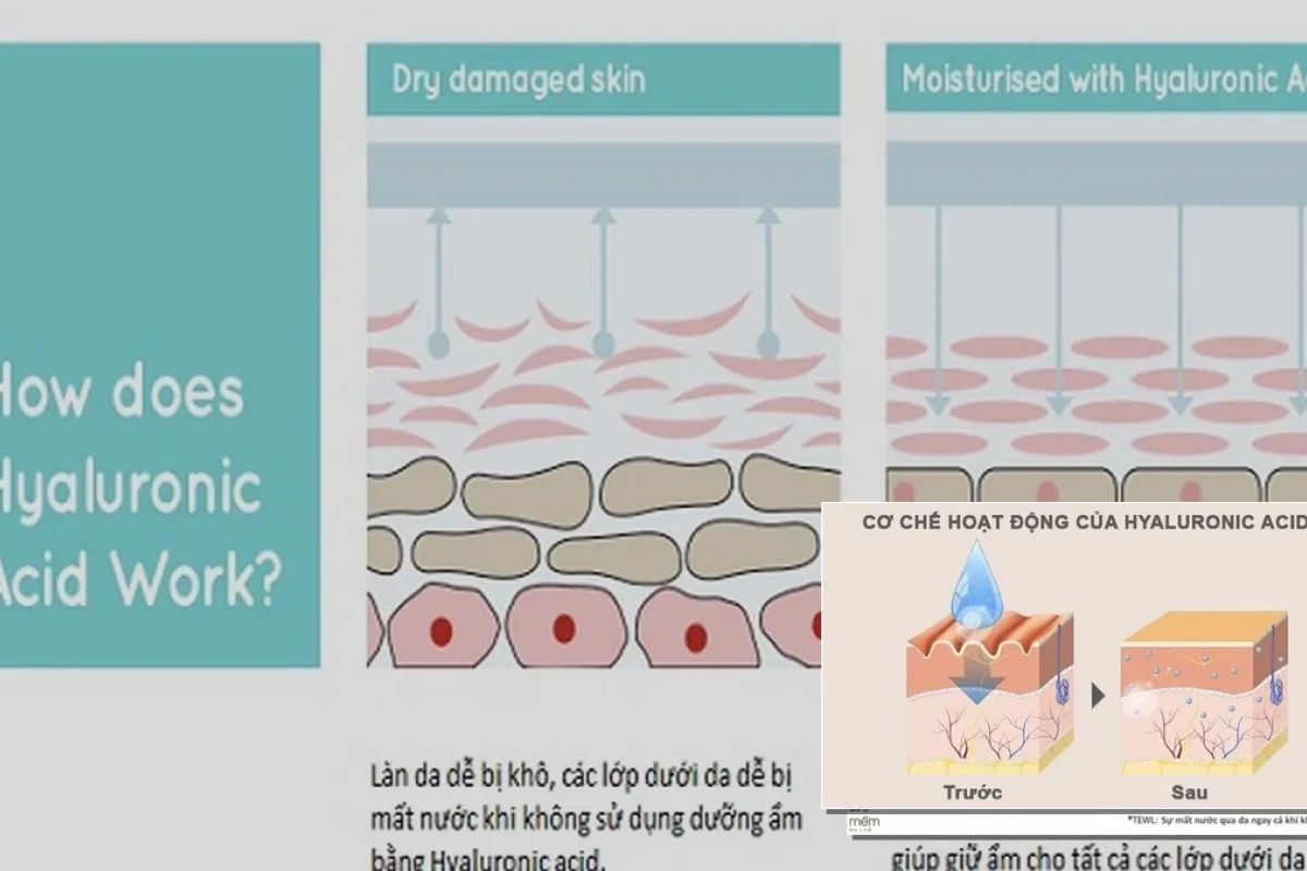 Axit Hyaluronic: Cơ Chế Hoạt Động Dưỡng Ẩm Da Chuyên Sâu