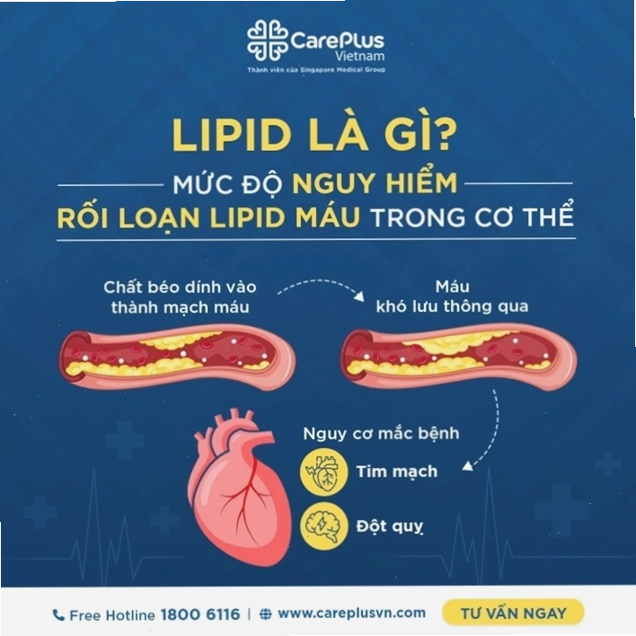 Lipid máu cần được theo dõi định kỳ để phát hiện sớm các vấn đề sức khỏe