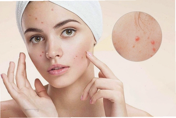 Ứng dụng của lưu huỳnh trong lĩnh vực làm đẹp và y tế
