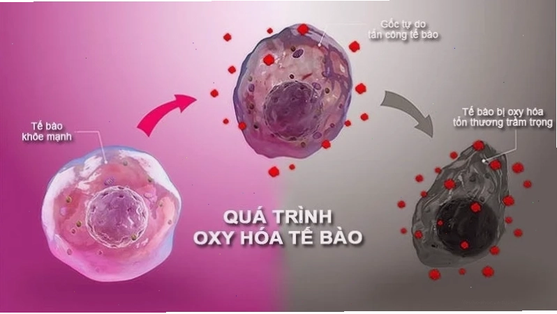 Chất chống oxy hóa trung hòa gốc tự do