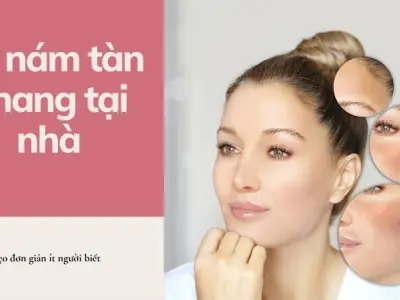 Trị nám tàn nhang tại nhà với mẹo đơn giản ít người biết