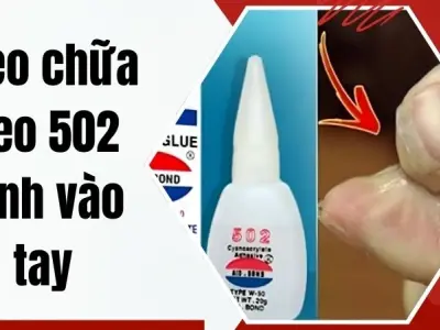 Bật mí mẹo chữa keo 502 dính vào tay cực đỉnh tại nhà