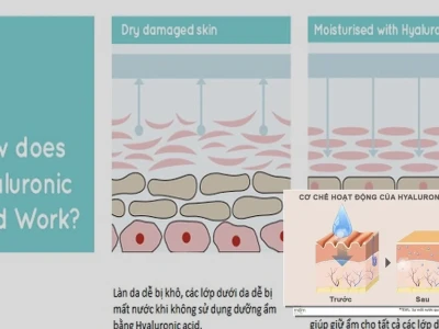Axit Hyaluronic: Cơ Chế Hoạt Động Dưỡng Ẩm Da Chuyên Sâu